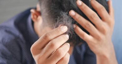 When to seek medical advice for hair loss