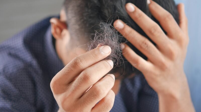 When to seek medical advice for hair loss