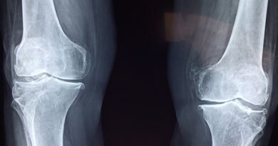 knee, x-ray, medical